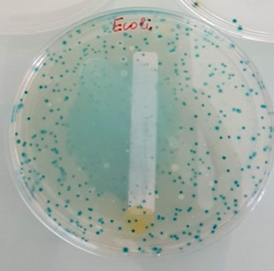 Analyses microbiologiques sur boites de pétri