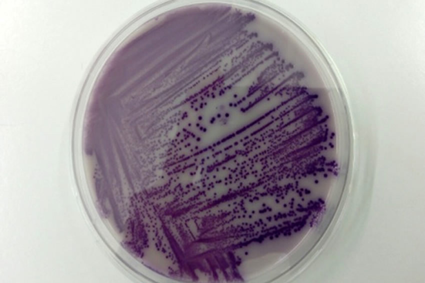 Analyses microbiologiques sur boites de pétri